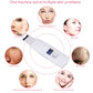 Ultrasonic Skin Scrubber Face Cleanser Blackhead Acne Removal Facial Spa Vibration Massager Ultrasound Peeling Clean Machine 394