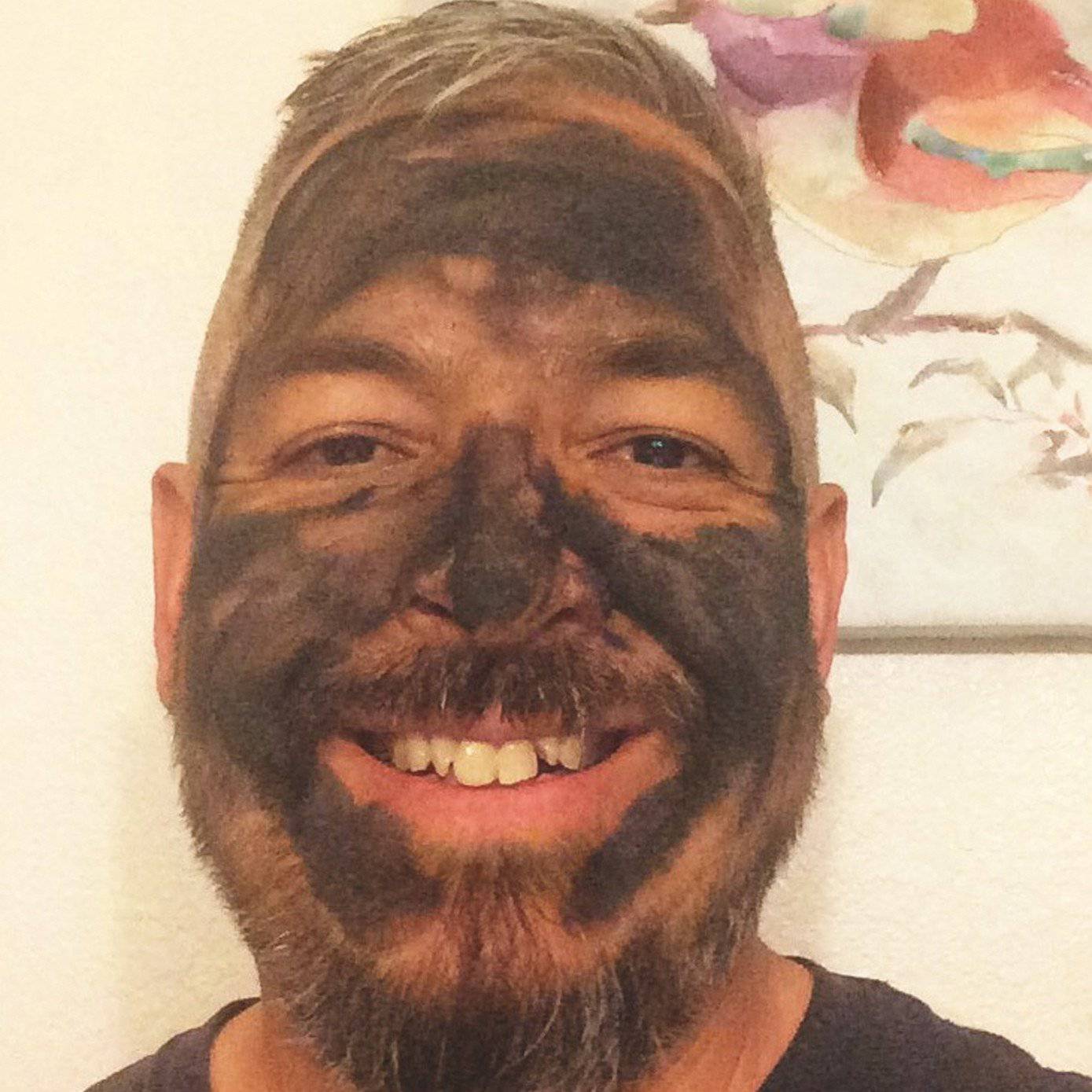 Organic Activated Charcoal Face Mask – Acne Detox Mask for Blackheads, Pores & Clear Skin